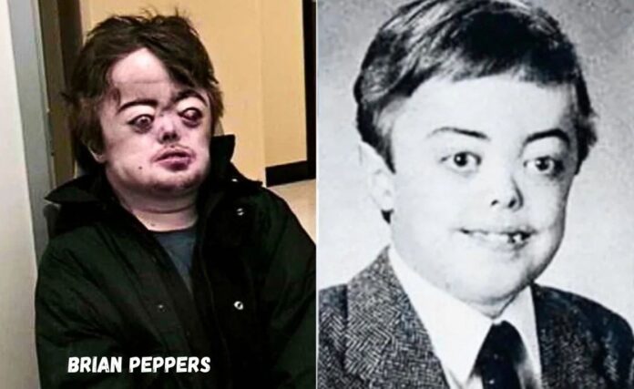 Brian Peppers